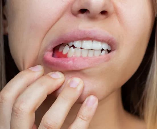 Objawy nowotworu dziąseł – nie bagatelizuj tych niepokojących sygnałów