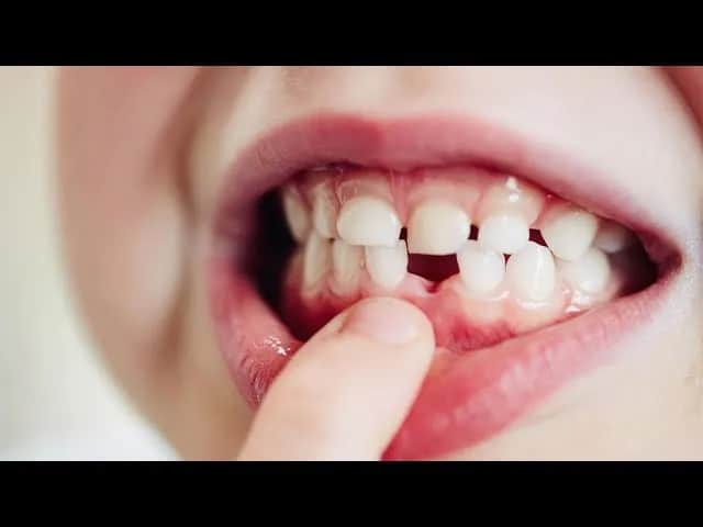Czy zęby stałe rosną z wiekiem? Odkryj, co się z nimi dzieje
