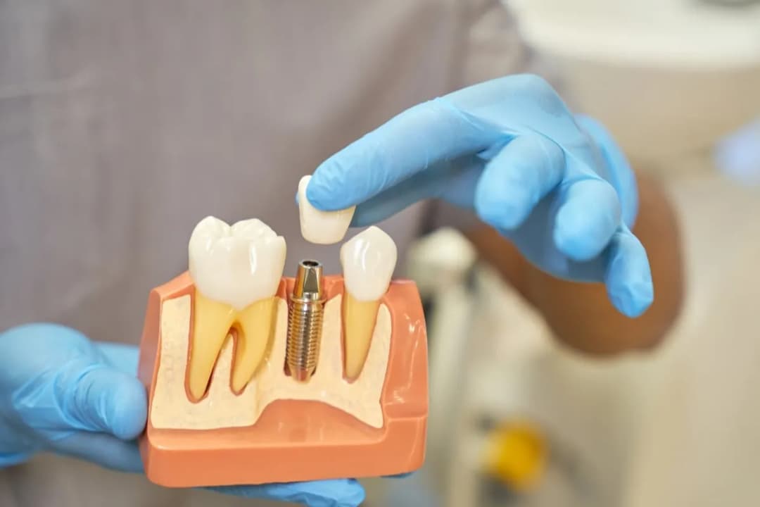 Jak dentysta sprawdza, który ząb boli i co musisz wiedzieć o bólu zębów